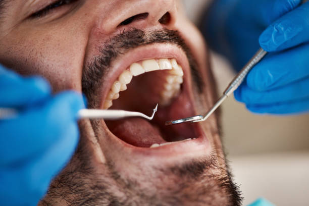 Best Emergency Treatment for Dental Infections or Abscesses in Twin Grove, IL