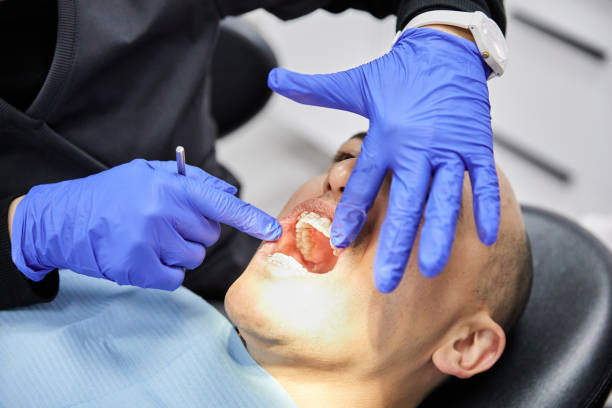 Best Emergency Tooth Extraction in Twin Grove, IL